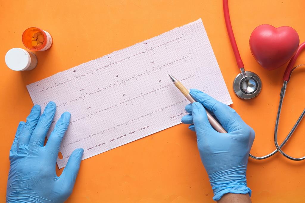 profissional analisando exame com batimentos cardiacos de um paciente